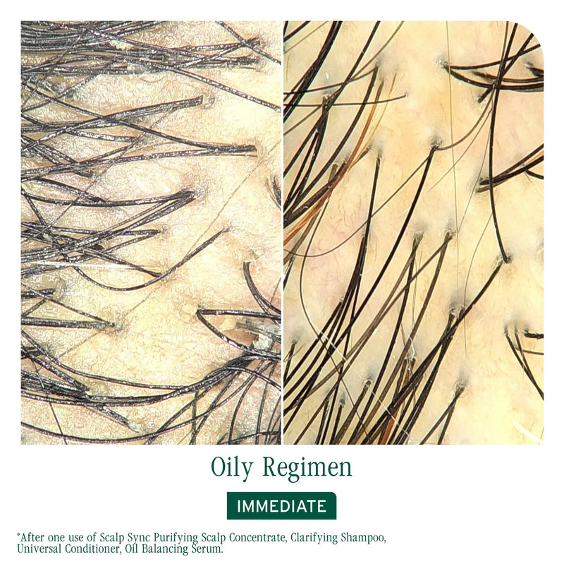 MATRIX BIOLAGE SCALP SYNC CLARIFYING SHAMPOO 400ML