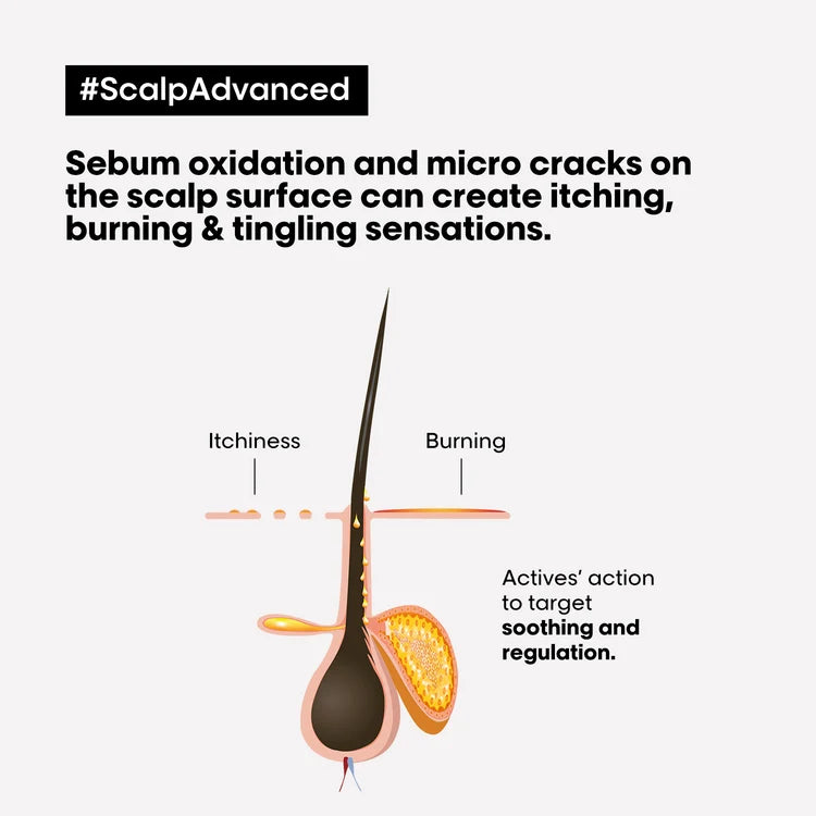 LOREAL SCALP ADVANCED ANTI DISCOMFORT TREATMENT 200ML